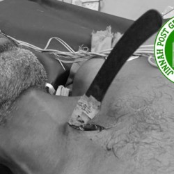 Man survives knife stab to neck after life-saving surgery at JPMC