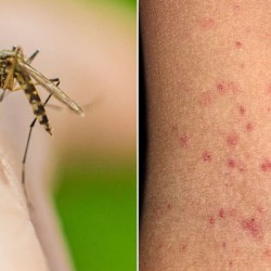 Dengue cases continue to rise across Sindh — over 1,100 new infections reported in 24 hours