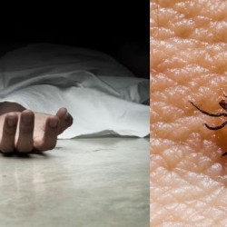 Second Death from Congo Virus Reported in Sindh