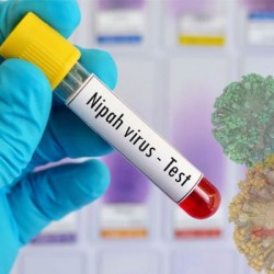 Sindh Issues High Alert Advisory on Nipah Virus Following Outbreak in India