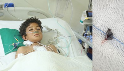 NICVD Karachi Saves 12-Year-Old Balochistan Boy After Bullet Lodges in Heart