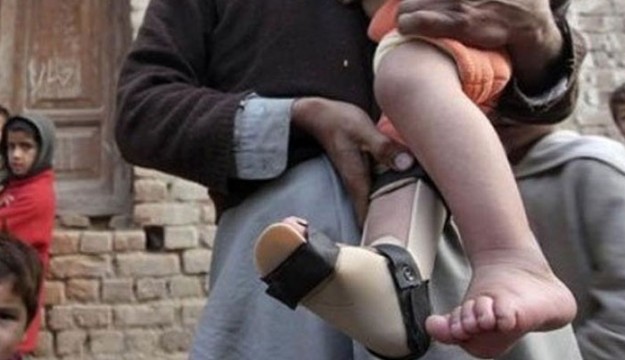 First Polio Case of 2026 Reported from Sujawal District, Sindh