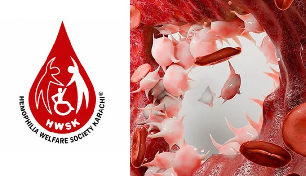 Civil Hospital Sanghar MS Visits HWSK, Praises Hemophilia Care Model