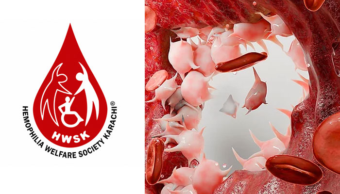 Civil Hospital Sanghar MS Visits HWSK, Praises Hemophilia Care Model