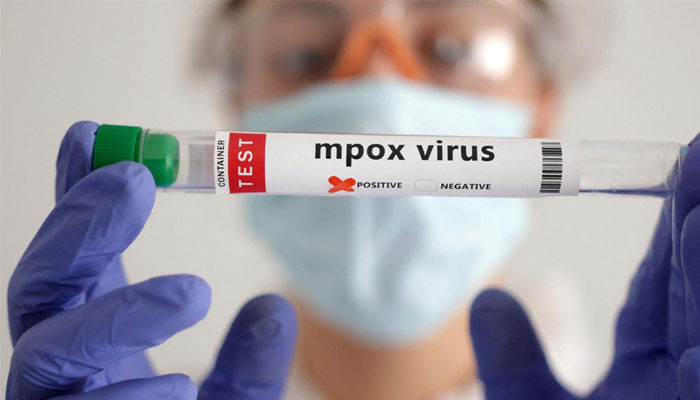 Second case of monkeypox confirmed in Sindh